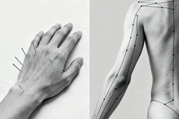 acupuntura-tung-vs-metodo-equilibrio-img